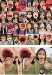 【恋物癖】46位美女口腔检查高清GIF动态图 [100P+2.96G][百度网盘下载 ]